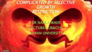 COMPLICATED BY SELECTIVE
GROWTH
RESTRICTION
DR NAHLA WAER
LECTURER OB&GYN
ASWAN UNIVERSITY
 