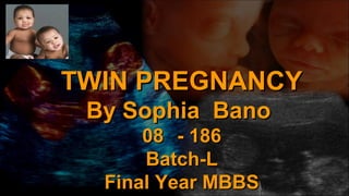 TWIN PREGNANCYTWIN PREGNANCY
By Sophia BanoBy Sophia Bano
0808 -- 186186
Batch-LBatch-L
Final Year MBBSFinal Year MBBS
 