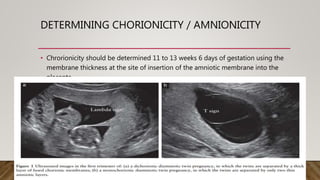 DETERMINING CHORIONICITY / AMNIONICITY
• Chrorionicity should be determined 11 to 13 weeks 6 days of gestation using the
membrane thickness at the site of insertion of the amniotic membrane into the
placenta
 