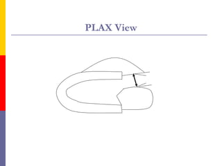 Plax Rvit With Color Two dimensional echocardiography | PPT