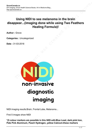GroveCanada.ca
DIY Imaging, Grove Health Science Books, Art in Medicine Blog...
http://grovecanada.ca
Using NIDI to see melanoma in the brain
disappear...(imaging done while using Two Feathers
Healing Formula)!
Author : Grove
Categories : Uncategorized
Date : 31-03-2018
NIDI imaging results:Brain, Frontal Lobe, Melanoma...
First 5 images show NIDI
*(5 colour markers are possible in this NIDI edit-Blue Lead, dark pink Iron,
Pale Pink Aluminum, Peach Hydrogen, yellow Calcium-these markers
This
content
was
created
by
Sari
Grove,
1 / 7
 