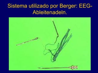 Sistema utilizado por Berger: EEG-
Ableitenadeln.
 