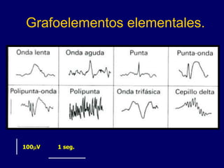 Grafoelementos elementales.
1 seg.
100mV
 