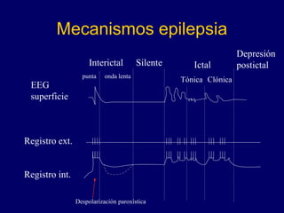 Mecanismos epilepsia
EEG
superficie
Interictal Silente Ictal
Depresión
postictal
Registro ext.
Registro int.
Tónica Clónica
punta onda lenta
Despolarización paroxística
 