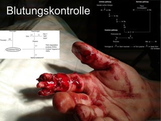Blutungskontrolle
 