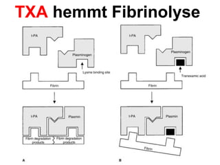 TXA hemmt Fibrinolyse
 