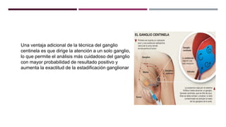 Una ventaja adicional de la técnica del ganglio
centinela es que dirige la atención a un solo ganglio,
lo que permite el análisis más cuidadoso del ganglio
con mayor probabilidad de resultado positivo y
aumenta la exactitud de la estadificación ganglionar
 