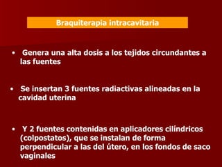 Braquiterapia intracavitaria Genera una alta dosis a los tejidos circundantes a las fuentes Se insertan 3 fuentes radiactivas alineadas en la cavidad uterina  Y 2 fuentes contenidas en aplicadores cilíndricos (colpostatos), que se instalan de forma perpendicular a las del útero, en los fondos de saco vaginales 