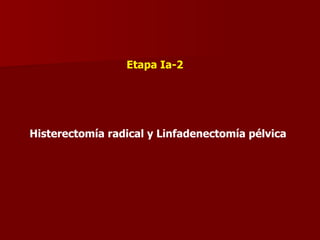 Etapa Ia-2 Histerectomía radical y Linfadenectomía pélvica 