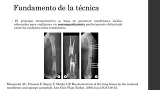 TX DEFECTOS ÓSEOS SEGMENTARIOS.pptx
