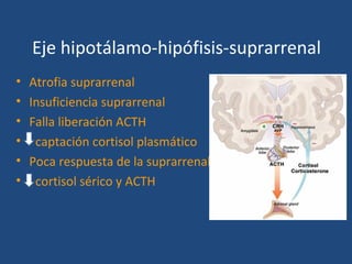 Eje hipotálamo-hipófisis-suprarrenal
•   Atrofia suprarrenal
•   Insuficiencia suprarrenal
•   Falla liberación ACTH
•    captación cortisol plasmático
•   Poca respuesta de la suprarrenal
•    cortisol sérico y ACTH
 