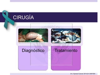 CIRUGÍA
Int J Gynecol Cancer 2014;24: S48YS54
 