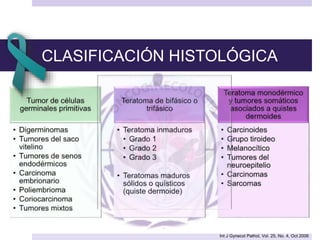 CLASIFICACIÓN HISTOLÓGICA
Int J Gynecol Pathol, Vol. 25, No. 4, Oct 2006
 