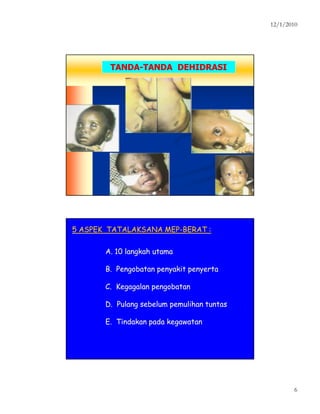 12/1/2010
6
TANDATANDA--TANDA DEHIDRASITANDA DEHIDRASI
5 ASPEK TATALAKSANA MEP5 ASPEK TATALAKSANA MEP--BERAT :BERAT :
A. 10 langkah utamaA. 10 langkah utama
B. Pengobatan penyakit penyertaB. Pengobatan penyakit penyerta
C. Kegagalan pengobatanC. Kegagalan pengobatan
D. Pulang sebelum pemulihan tuntasD. Pulang sebelum pemulihan tuntas
E. Tindakan pada kegawatanE. Tindakan pada kegawatan
 