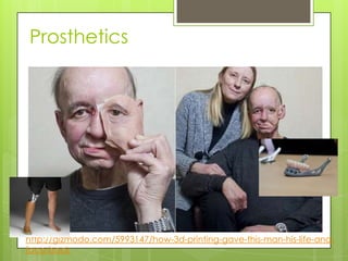 Prosthetics
http://gizmodo.com/5993147/how-3d-printing-gave-this-man-his-life-and-
face-back
 