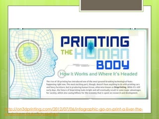 Bio-printing
http://on3dprinting.com/2012/07/06/infographic-go-on-print-a-liver-the-
evolution-of-bio-3d-printing/
 