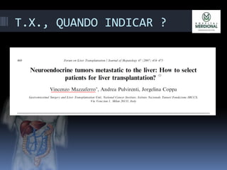 T.X., QUANDO INDICAR ?
 