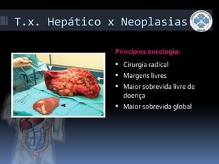 T.x. Hepático x Neoplasias:
Princípios oncologia:
 Cirurgia radical
 Margens livres
 Maior sobrevida livre de
doença
 Maior sobrevida global
 