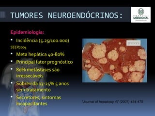 TUMORES NEUROENDÓCRINOS:
Epidemiologia:
 Incidência (5.25/100.000)
SEER2004
 Meta hepática 40-80%
 Principal fator prognóstico
 80% metástases são
irressecáveis
 Sobrevida 13-25% 5 anos
sem tratamento
 Secretores, sintomas
incapacitantes *Journal of hepatoloy 47 (2007) 454-475
 