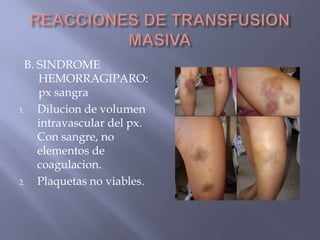 B. SINDROME
     HEMORRAGIPARO:
     px sangra
1.   Dilucion de volumen
     intravascular del px.
     Con sangre, no
     elementos de
     coagulacion.
2.   Plaquetas no viables.
 