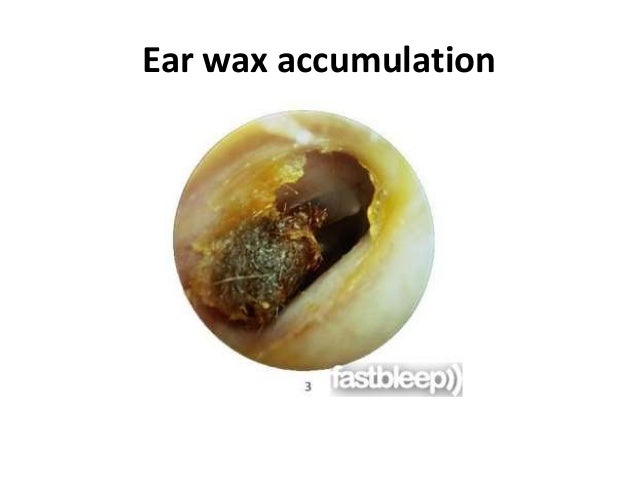 Tympanic membrane