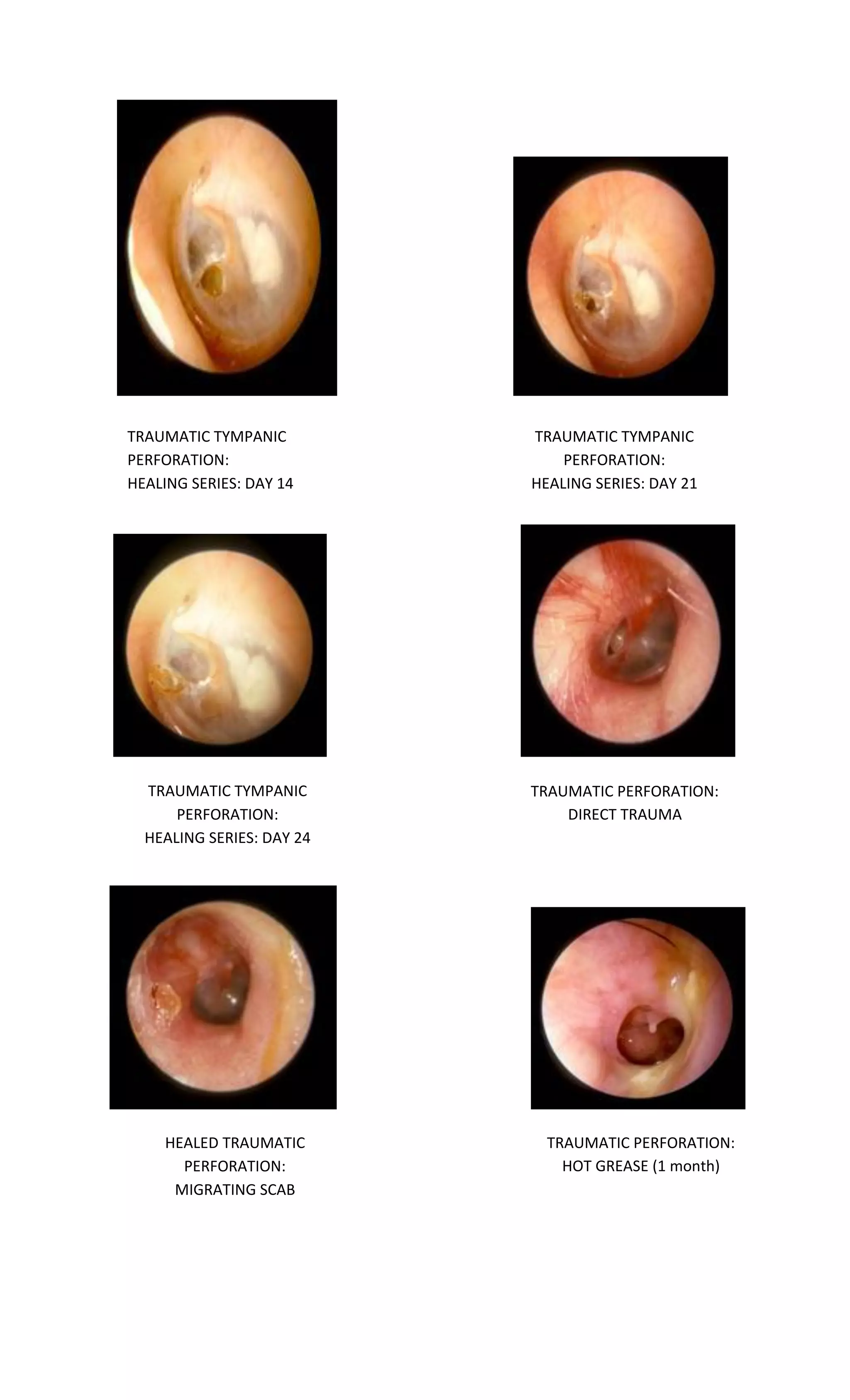 Tympanic membrane dr. fadil | PDF