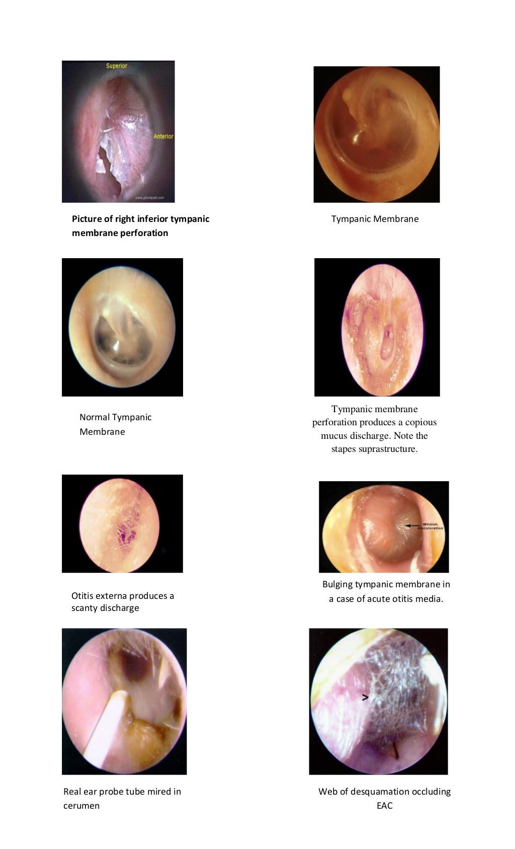 Tympanic membrane dr. fadil