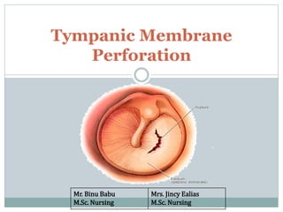 Tympanic Membrane
Perforation
Mr. Binu Babu
M.Sc. Nursing
Mrs. Jincy Ealias
M.Sc. Nursing
 