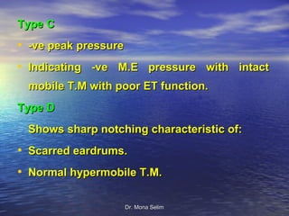 Type C
• -ve peak pressure
• Indicating -ve M.E pressure with intact
 mobile T.M with poor ET function.
Type D
 Shows sharp notching characteristic of:
• Scarred eardrums.
• Normal hypermobile T.M.

                      Dr. Mona Selim
 