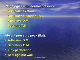 Pathologies with normal pressure:
•   Ossicular fixation.
•   Ossicular discontinuity.
•   Adhesive O.M.
•   Scarring T.M.


Absent pressure peak (flat):
•   Adhesive O.M.
•   Secretory O.M.
•   Tiny perforation.
•   Seal against wall.
                         Dr. Mona Selim
 