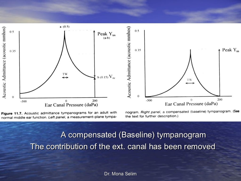 Tympanometry & Clinical Applications