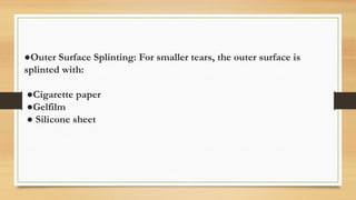 ●Outer Surface Splinting: For smaller tears, the outer surface is
splinted with:
●Cigarette paper
●Gelfilm
● Silicone sheet
 