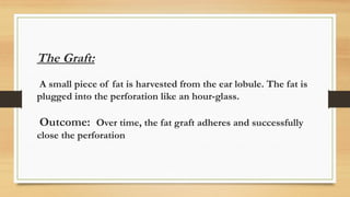 The Graft:
A small piece of fat is harvested from the ear lobule. The fat is
plugged into the perforation like an hour-glass.
Outcome: Over time, the fat graft adheres and successfully
close the perforation
 