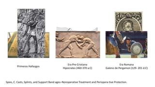 Historia de los yesos traumatologia y ortopedia | PPTX