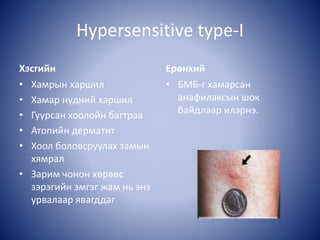 Hypersensitive type-I
Хэсгийн
• Хамрын харшил
• Хамар нүдний харшил
• Гуурсан хоолойн багтраа
• Атопийн дерматит
• Хоол боловсруулах замын
хямрал
• Зарим чонон хөрвөс
зэрэгийн эмгэг жам нь энэ
урвалаар явагддаг
Ерөнхий
• БМБ-г хамарсан
анафилаксын шок
байдлаар илэрнэ.
 