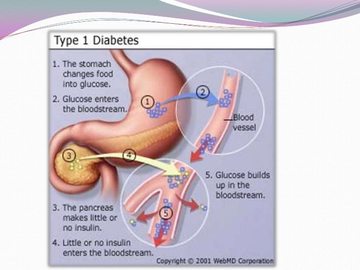 Type 1 diabetes anatomy2
