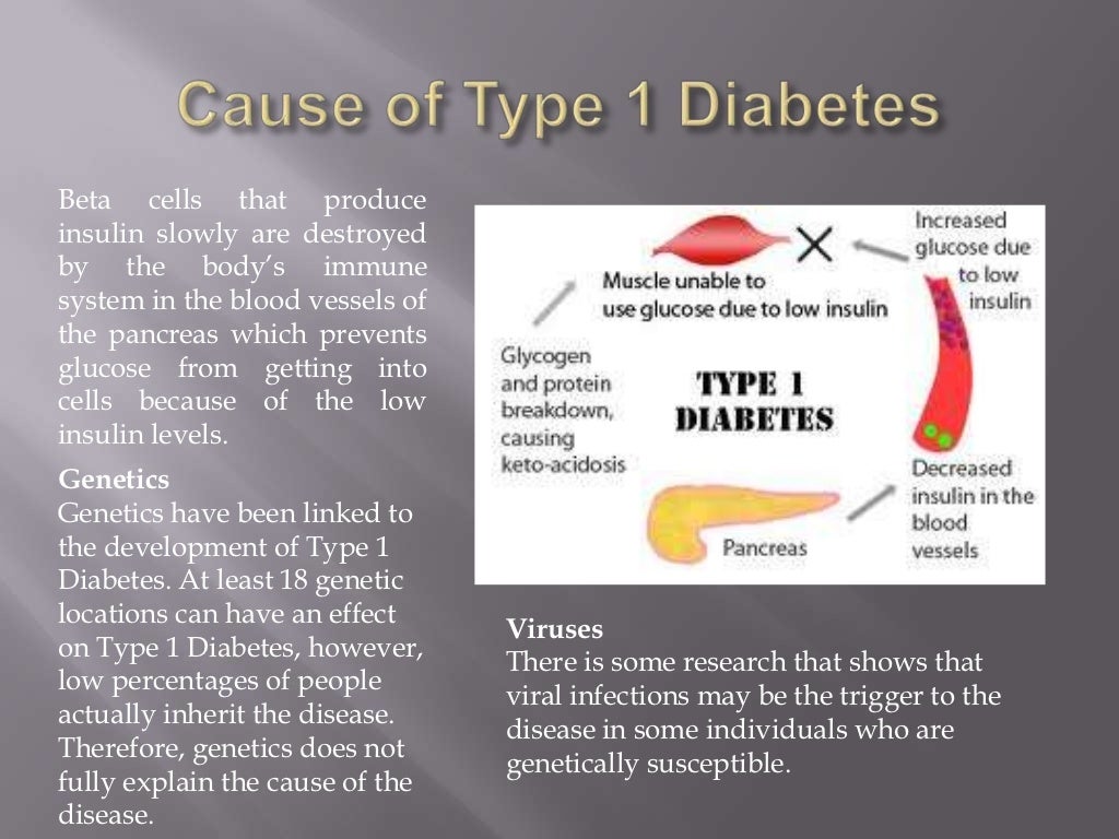 presentation of diabetes type 1