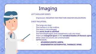 Imaging
LEFT SHOULDER SERIES:
- Impression: NEGATIVE FOR FRACTURE AND/OR DISLOCATION:
CHEST PA/LATERAL
- The lungs are clear:
- The trachea is in the midline.
- The heart is not enlarged.
- The aortic knob is calcified.
- The hemidiaphragms and costophrenic sulci are intact.
- There are marginal spurs in the vertebral bodies of thoracic spine.
- Other chest structures are unremarkable.
- IMPRESSION:
- ATHEROSCLEROTIC AORTA.
- DEGENERATIVE OSTEOPHYTES, THORACIC SPINE.
 
