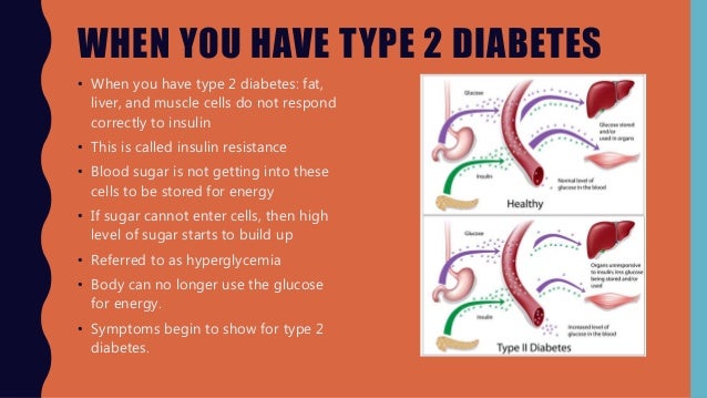 Type 2 diabetes quick guide