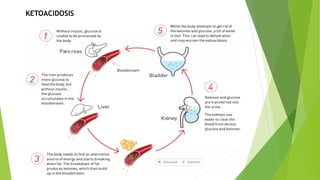 KETOACIDOSIS
 