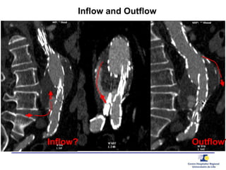 Inflow and Outflow
Inflow? Outflow?
 