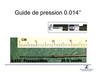 Guide de pression 0.014’’
20 G needle0.014’’ PressureWire
 