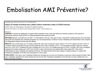 Embolisation AMI Préventive?
 