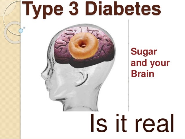 research on type 3 diabetes