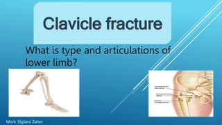 What is type and articulations of
lower limb?
Work :Elgilani Zaher
 