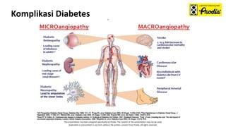 This presentation has been prepared specifically by Prodia. The content of this presentation may not be used,
duplicated or transmitted in any form without the written consent from Prodia. All rights reserved.
Komplikasi Diabetes
 