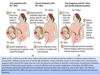 When an Rh− mother has an Rh+ fetus, fetal erythrocytes are introduced into the mother’s circulatory system before or
during birth, leading to production of anti-Rh IgG antibodies. These antibodies remain in the mother and, if she becomes
pregnant with a second Rh+ baby, they can cross the placenta and attach to fetal Rh+ erythrocytes. Complement-mediated
hemolysis of fetal erythrocytes results in a lack of sufficient cells for proper oxygenation of the fetus. (b) HDN can be
prevented by administering Rho(D) immune globulin during and after each pregnancy with an Rh+ fetus. The immune
globulin binds fetal Rh+ RBCs that gain access to the mother’s bloodstream, preventing activation of her primary immune
response.
 
