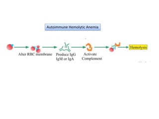 Autoimmune Hemolytic Anemia
 