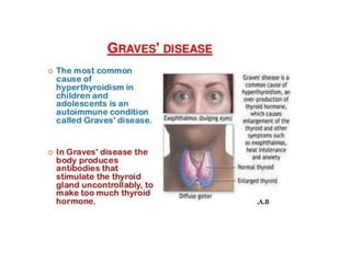 Type II Hypersensitivity-Antibody mediated cytotoxic Hypersensitivity
