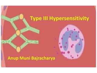 Type III Hypersensitivity
Anup Muni Bajracharya
 
